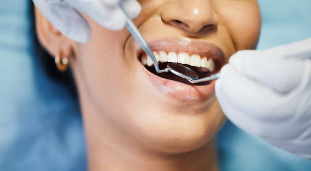 Best Emergency Dental Care for Broken or Chipped Teeth in North Caldwell, NJ