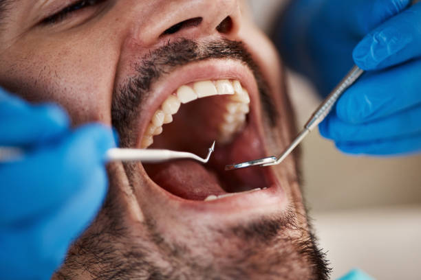 Best Cosmetic Emergency Dentistry in North Caldwell, NJ